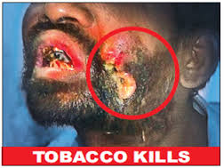 तम्बाकू के ‘सादे पैकेट’ पर चित्रमय चेतावनी क्यों है अधिक प्रभावकारी?